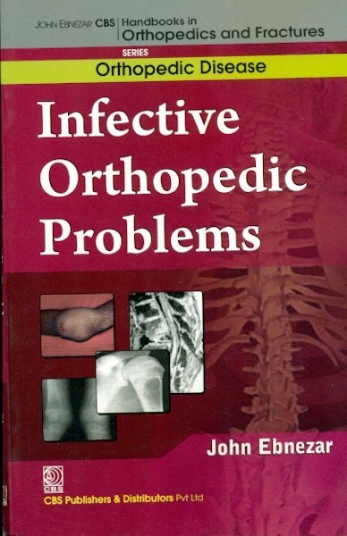 Infective Orthopedic Problems Developmental Orthopedic Problems (Handbooks In Orthopedics And Fractures Series Vol 31 Orthopedic Disease) (Pb 2012)