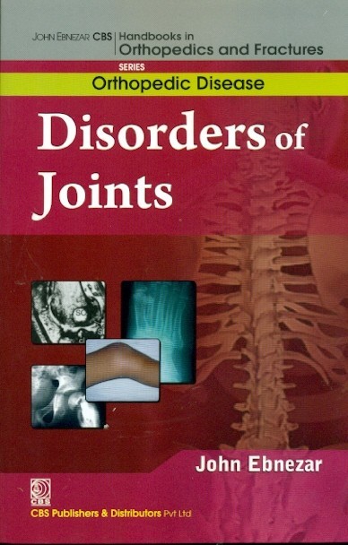 Disorders Of Joints (Handbooks In Orthopedics And Fractures Series Vol 32 Orthopedic Disease (2012)