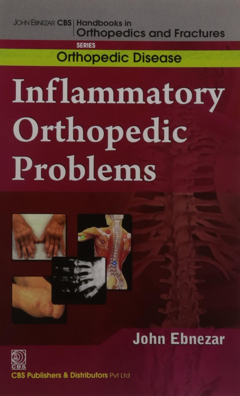 Inflammatory Orthopedic Problems (Handbooks In Orthopedics And Fractures Series Vol 34 Orthopedic Disease (2012)