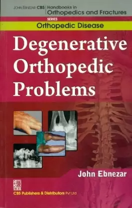 Degenerative Orthopedic Problems (Handbooks In Orthopedics And Fractures Series Vol35 Orthopedic Disease)Ma (2012)