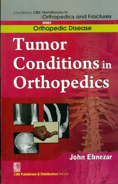 Tumor Conditions In Orthopedics (Handbooks In Orthopedics And Fractures Series Vol 36 Orthopedic Disease (2012)