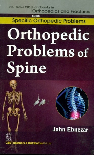 Orthopedic Problems Of Spine (Handbooks In Orthopedics And Fractures Series Vol 38 Specific Orthopedic Problems (2012)
