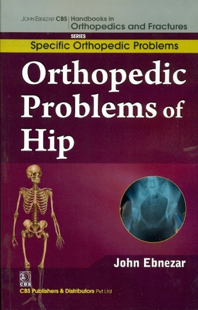Orthopedic Problems Of Hip (Handbooks In Orthopedics And Fractures Series Vol 40 Specific Orthopedic Problems (2012)