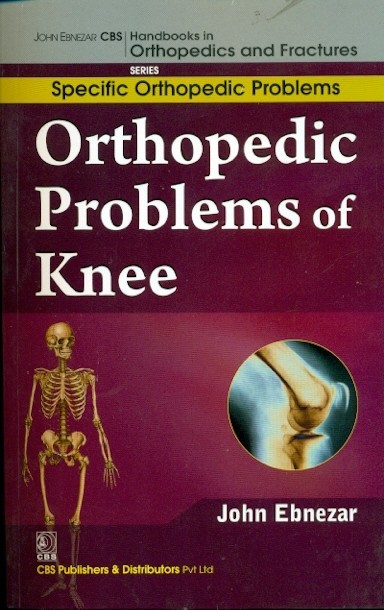 Orthopedic Problems Of Knee (Handbooks In Orthopedics And Fractures Series Vol 41 Specific Orthopedic Problems (2012)