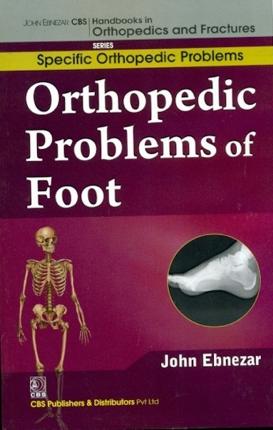 Orthopedic Problems Of Foot (Handbooks In Orthopedics And Fractures Series Vol 42 Specific Orthopedic Problems (2012)