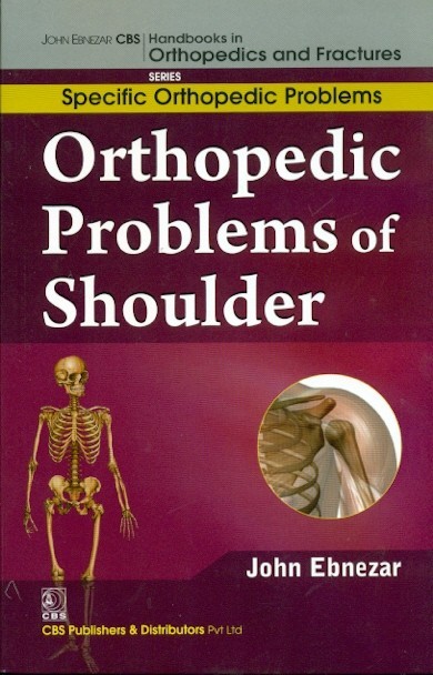Orthopedic Problems Of Shoulder (Handbooks In Orthopedics And Fractures Series Vol 43 Specific Orthpedic Problems (2012)