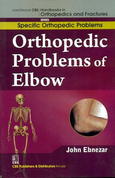 Orthopedic Problems Of Elbow (Handbooks In Orthopedics And Fractures Series Vol 44 Specific Orthopedic Problems (2012)