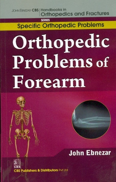 Orthopedic Problems Of Forearm (Handbooks In Orthopedics And Fractures Series Vol 45 Specific Orthopedic Problems (2012)