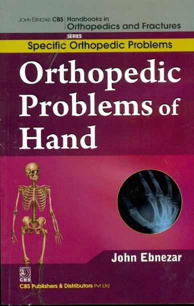 Orthopedic Problems Of Hand (Handbooks In Orthopedics And Fractures Series Vol 47 Specific Orthopedic Problems (2012)