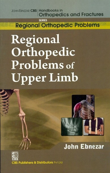 Regional Orthopedic Problems Of Upper Limb (Handbooks In Orthopedics And Fractures Series Vol 48 Regional Orthopedic Problems (2012)
