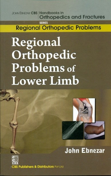Regional Orthopedic Problems Of Lower Limb (Handbooks In Orthopedics And Fractures Series Vol 49 Regional Orthopedic Problems (2012)