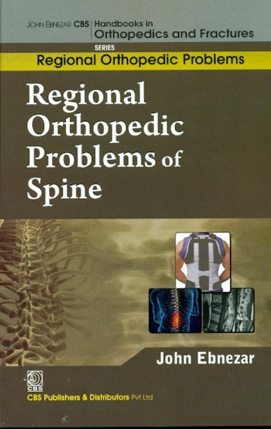 Regional Orthopedic Problems Of Spine (Handbooks In Orthopedics And Fractures Series Vol 50 Regional Orthopedic Problems (2012)
