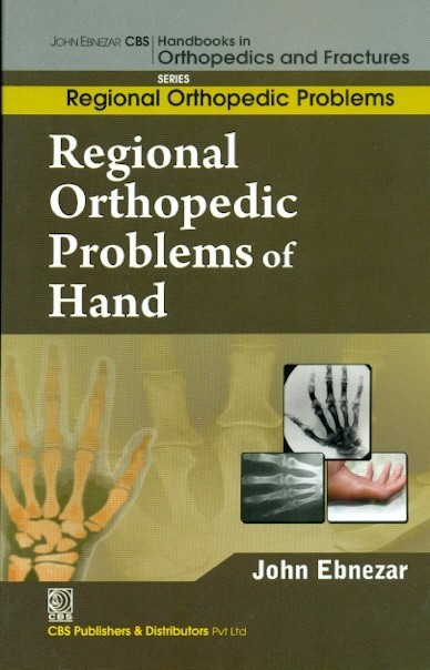 Regional Orthopedic Problems Of Hand (Handbooks In Orthopedics And Fractures Series Vol 51 Regional Orthopedic Problems (2012)