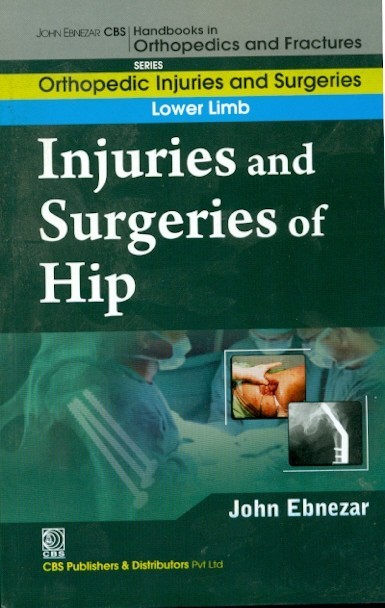 Injuries And Surgeries Of Hip (Handbooks In Orthopedics And Fractures Series Vol 55 Orthopedic Injuries And Surgeries Lower Limb (2012)