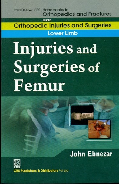 Injuries And Surgeries Of Femur (Handbooks In Orthopedics And Fractures Series Vol 56 Lower Limb (2012)