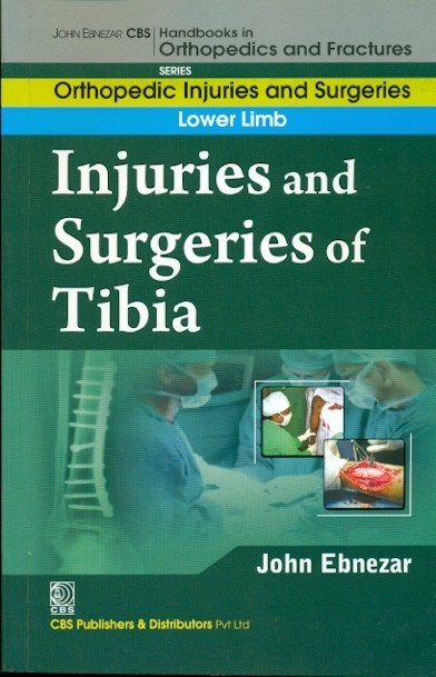 Injuries And Surgeries Of Tibia (Handbooks In Orthopedics And Fractures Series Vol 57 Orthopedic Injuries And Surgeries Lower Limb (2012)