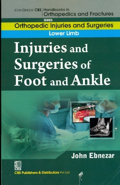 Injuries And Surgeries Of Foot And Ankle (Handbooks In Orthopedics And Fractures Series Vol 58 Orthopedic Injuries And Surgeries Lower Limb (2012)