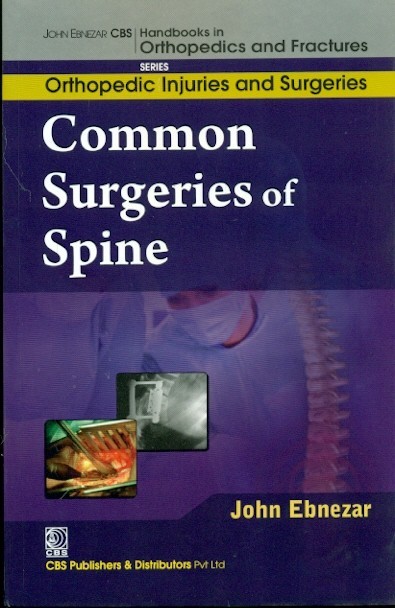 Common Surgeries Of Spine (Handbooks In Orthopedics And Fractures Series Vol 59 Orthopedic Injuries And Surgeries (2012)