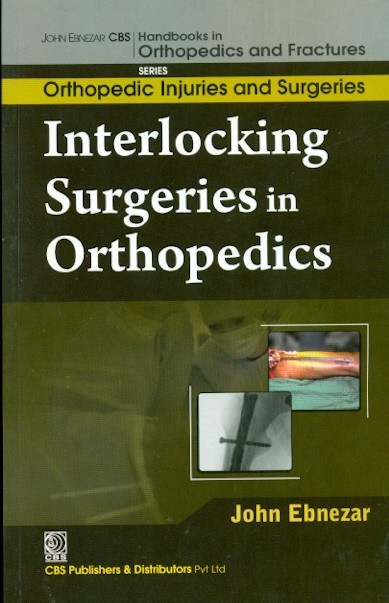 Interlocking Surgeries In Orthopedics (Handbooks In Orthopedics And Fractures Series Vol 60 Orthopedic Injuries And Surgeries (2012)