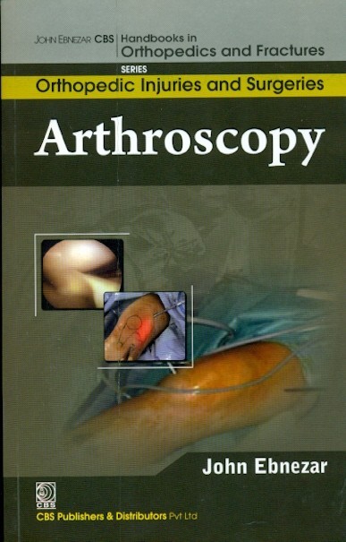 Arthroscopy (Handbooks In Orthopedics And Fractures Series Vol 61 Orthopedic Injuries And Surgeries (2012)