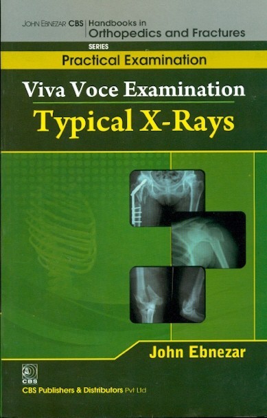 Typical X Rays (Handbooks In Orthopedics And Fractures Series Vol 65 Practical Examination (2012)