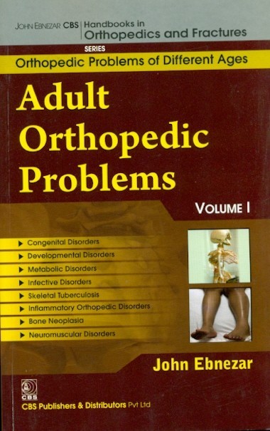 Adult Orthopedic Problems Vol 1 (Handbooks In Orthopedics And Fractures Series Vol 73 Orthopedic Problems And Different Ages (2012)