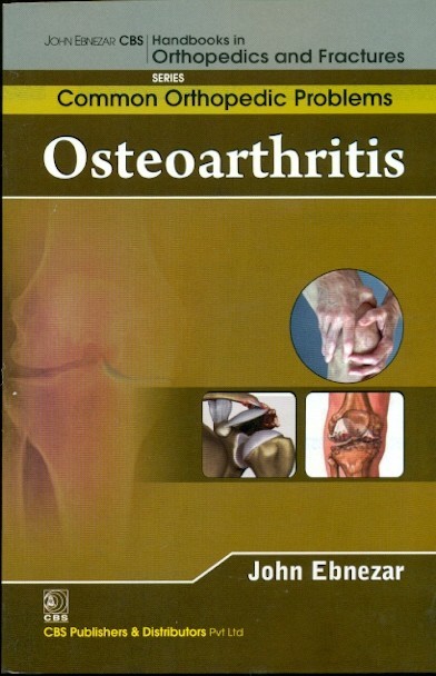 Osteoarthritis (Handbooks In Orthopedics And Fractures Series Vol 87 Common Orthopedic Problems (2012)