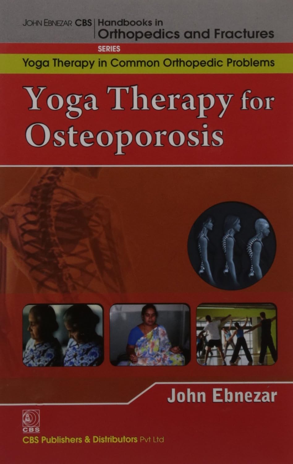 Yoga Therapy For Osteoporosis (Handbooks In Orthopedics And Fractures Series Vol 96 Yoga Therapy In Common Orthopedic Problems (2012)