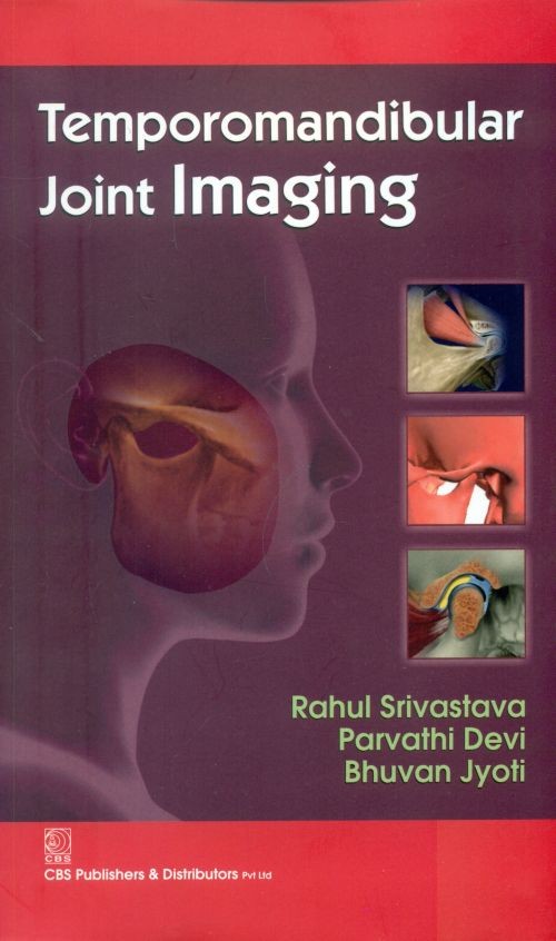 Temporomandibular Joint Imaging (Pb 2014)
