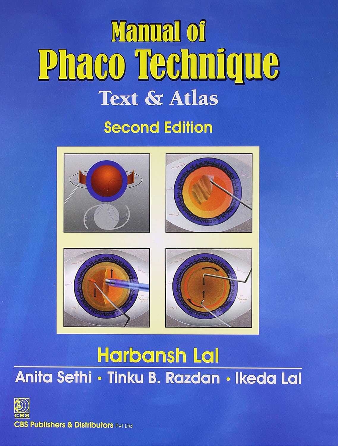 Manual Of Phaco Technique Text And Atlas 2Ed (Hb 2021)