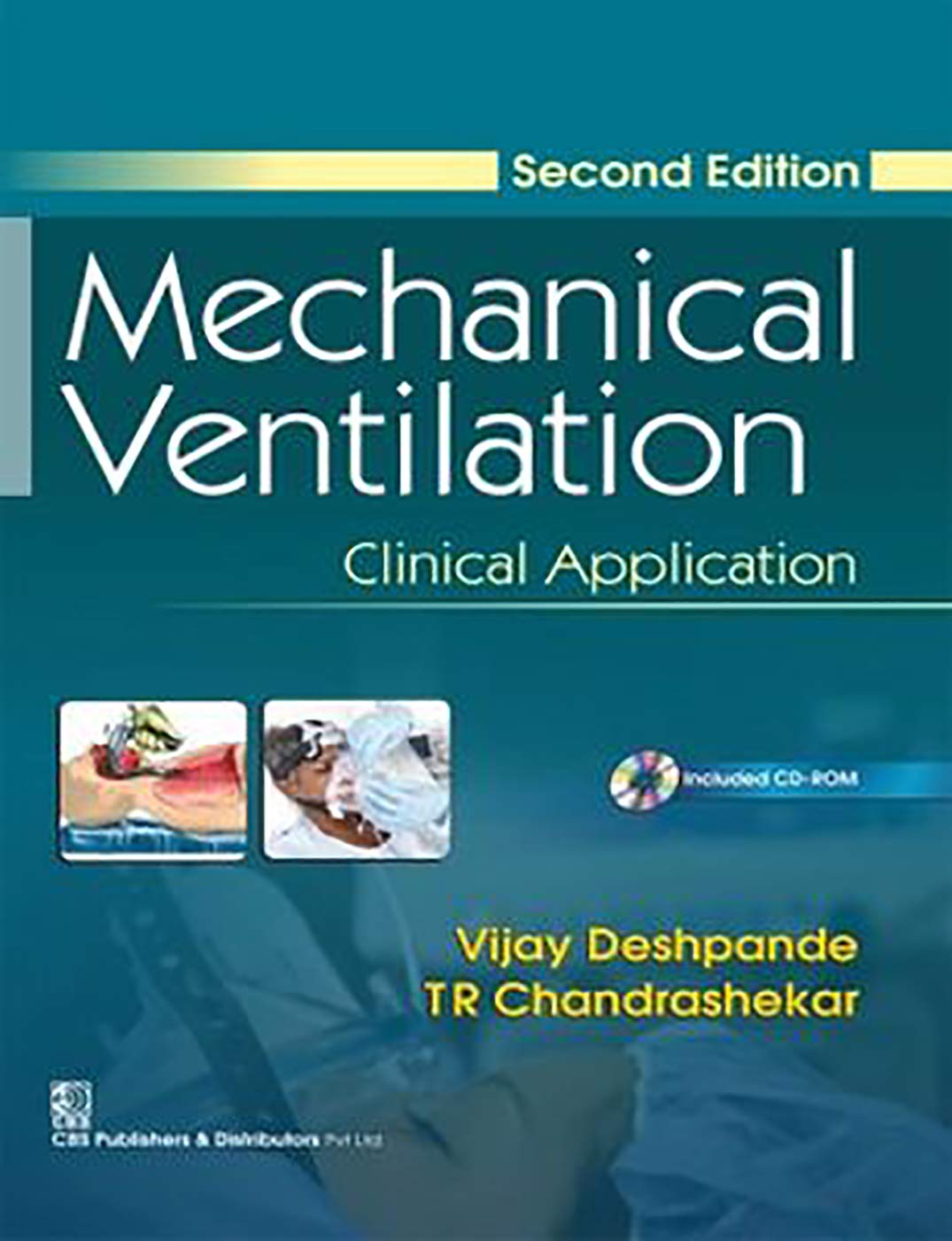 Mechanical Ventilation: Clinical Application, 2E (Pb)