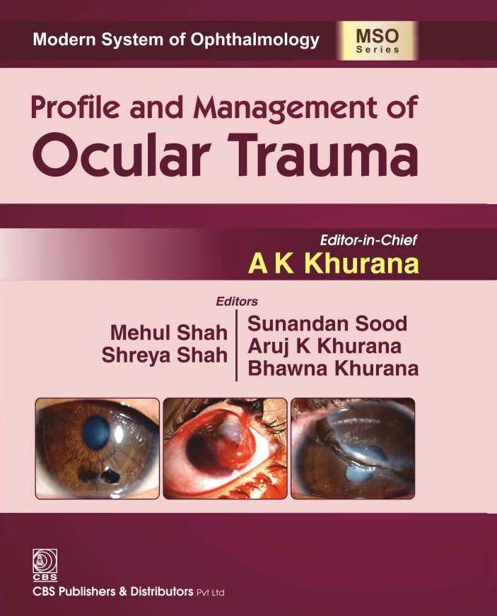 Profile And Management Of Ocular Trauma (Mso Series) 2016 (Hb 2024)