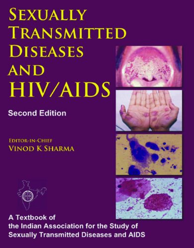 Sexually Transmitted Diseases And Hiv/Aids