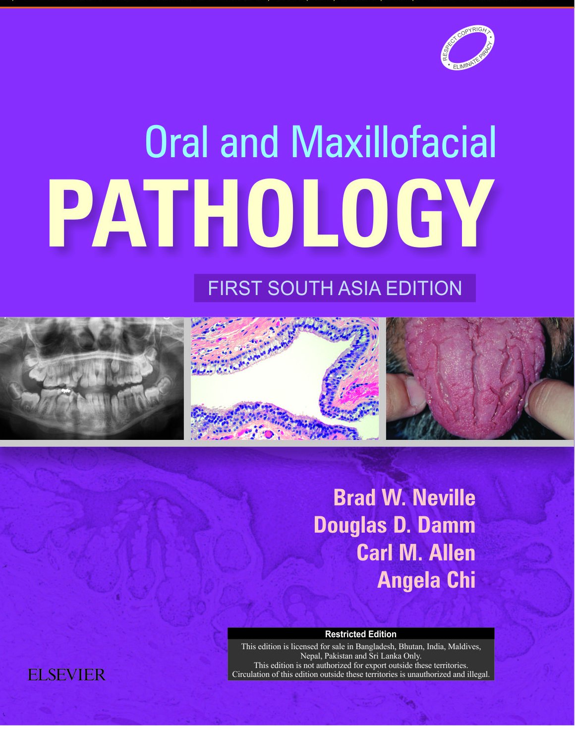 Oral And Maxillofacial Pathology: First South Asia Edition