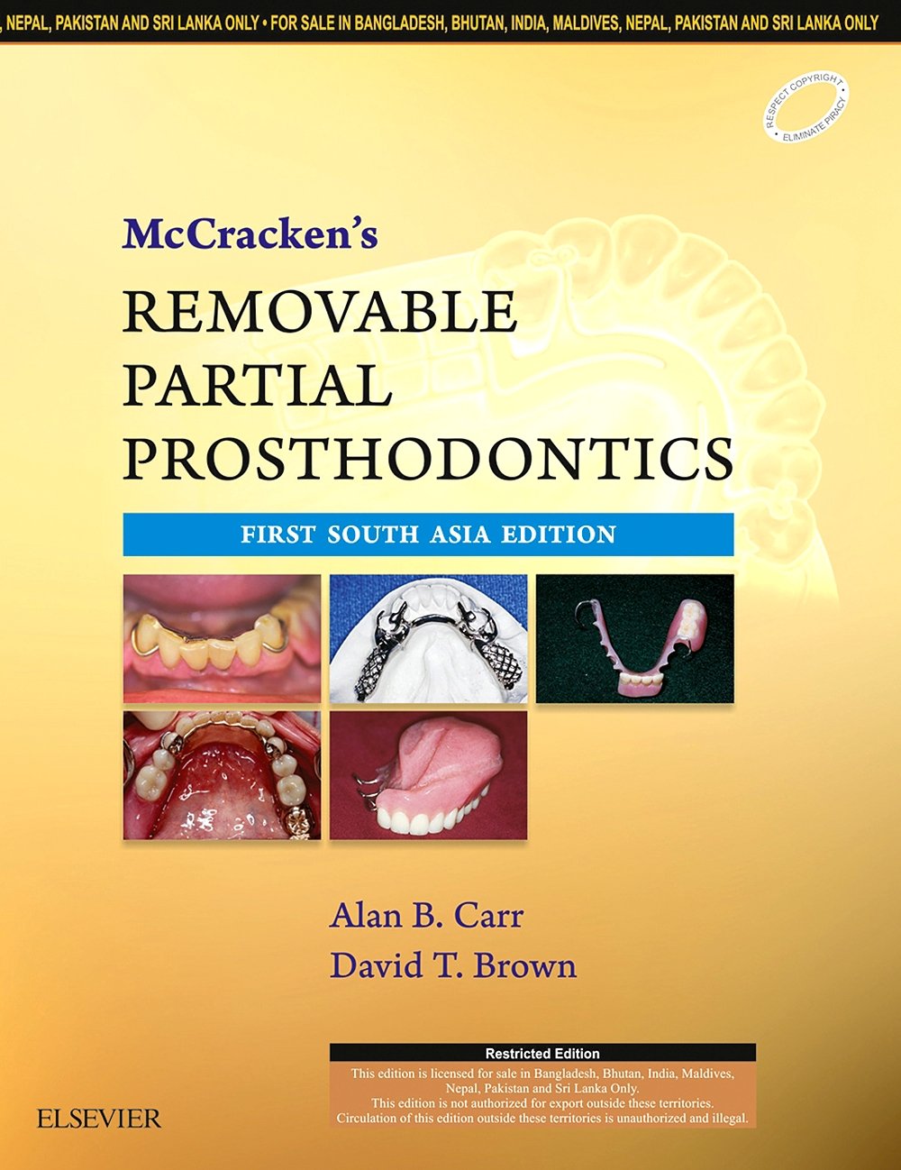 Mc Cracken'S Removable Partial Prosthodontics: First South Asia Edition