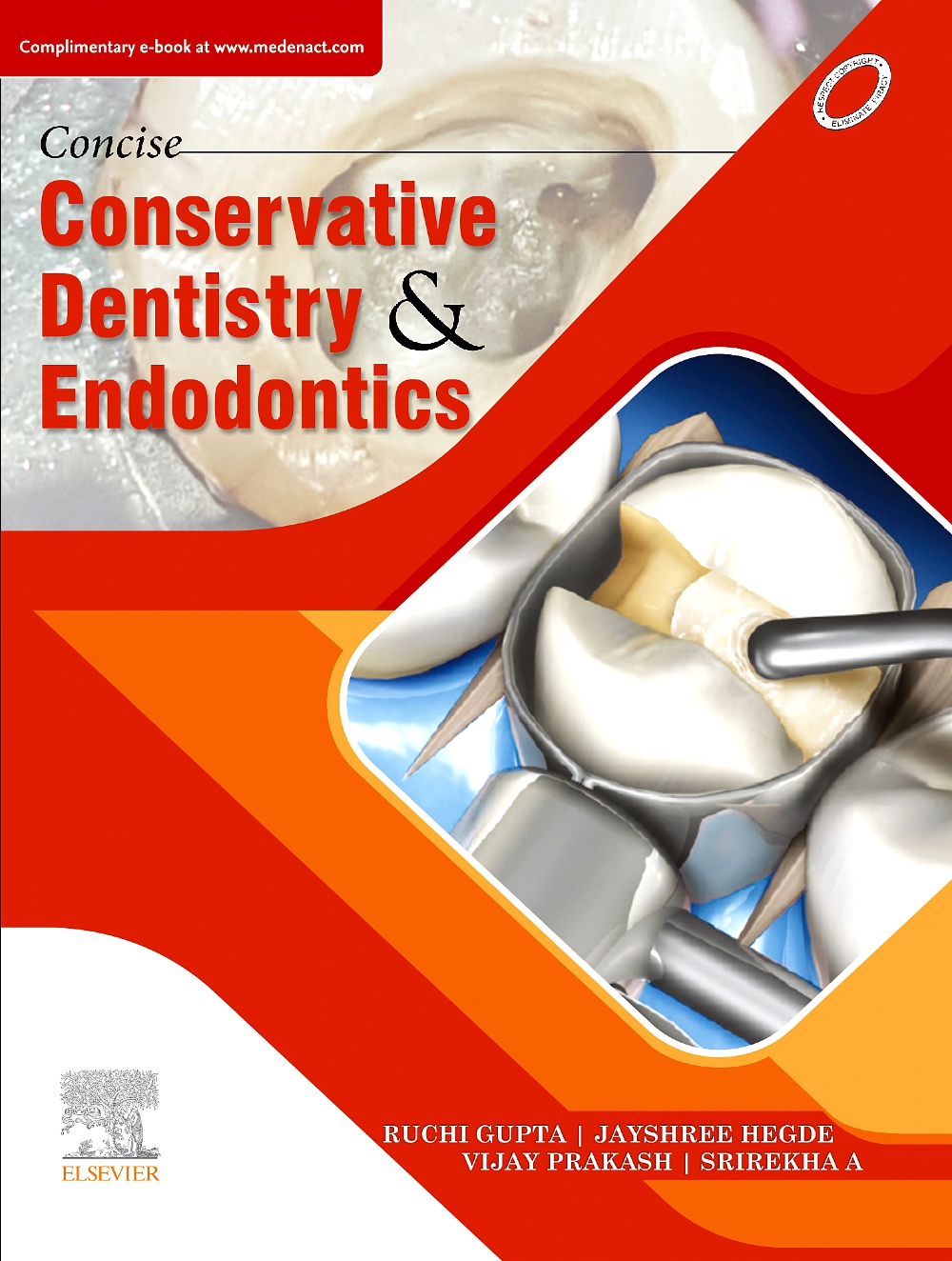 Concise Conservative Dentistry And Endodontics, 1E