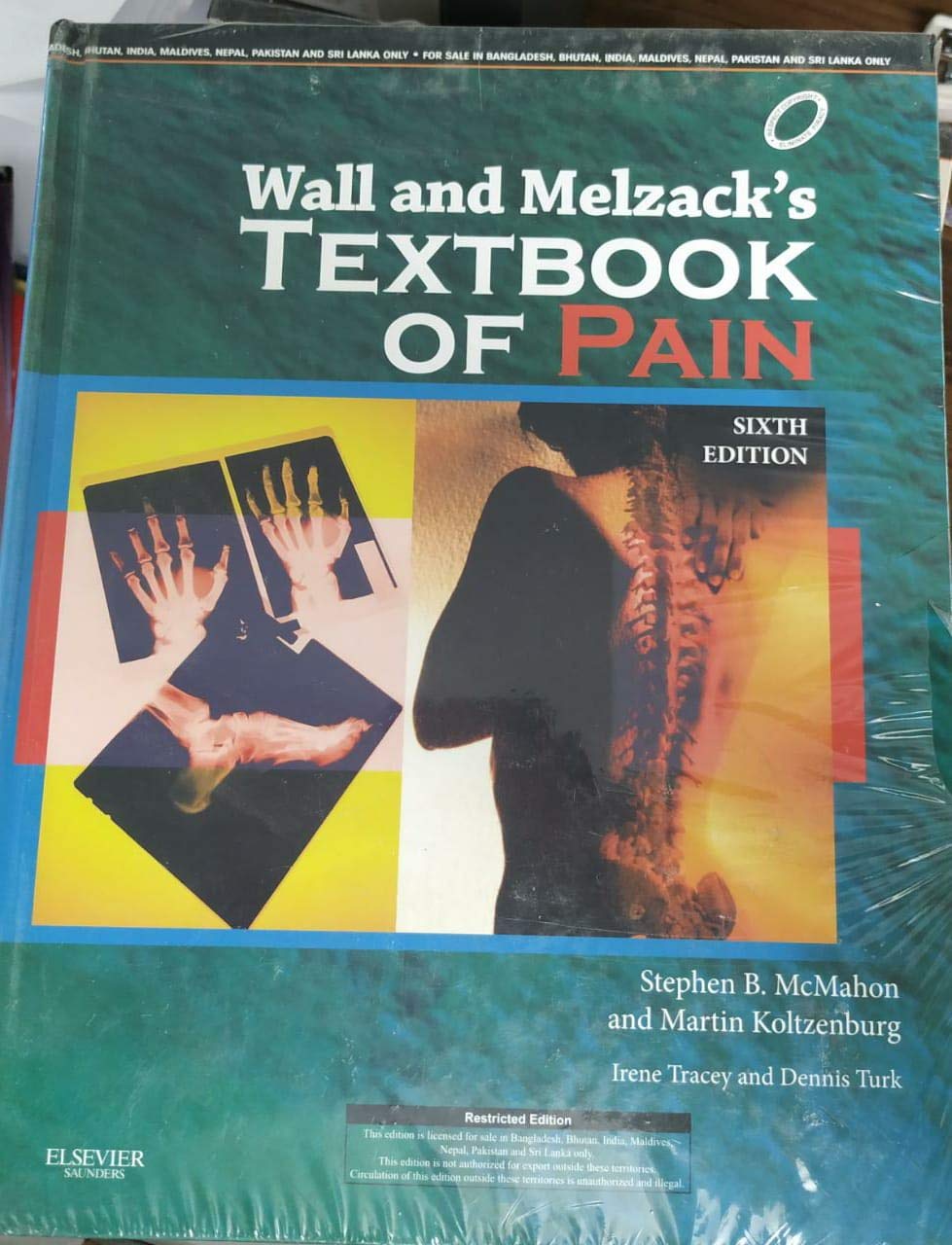 Wall & Melzack'S Textbook Of Pain: Expert Consult - Online And Print, 6E