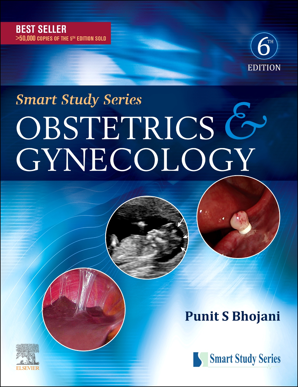 Smart Study Series: Obstetrics And Gynecology, 6E