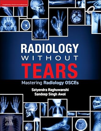 Radiology Without Tears: Mastering Radiology OSCEs