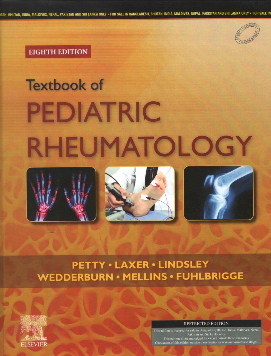 Textbook of Pediatric Rheumatology: 8ed