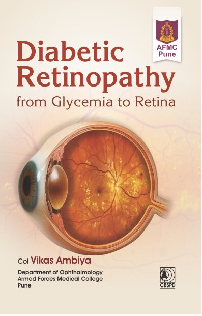 DIABETIC RETINOPATHY FROM GLYCEMIA TO RETINA (PB 2027)