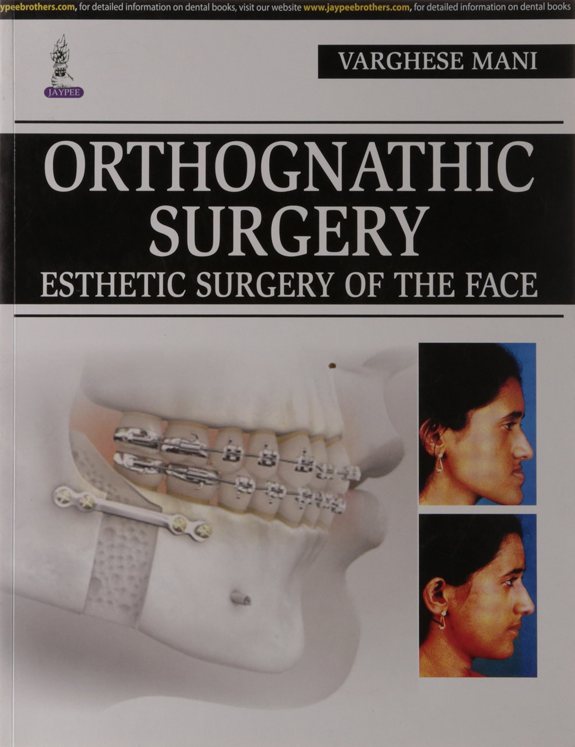 Orthognathic Surgery Esthetic Surgery Of The Face