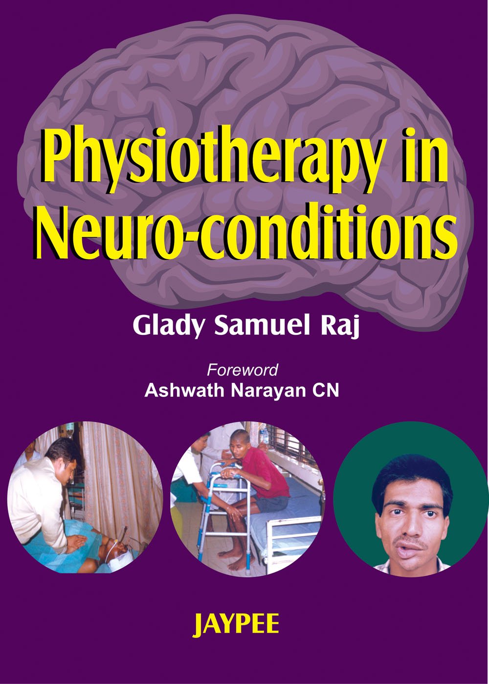 Physiotherapy In Neuro-Conditions