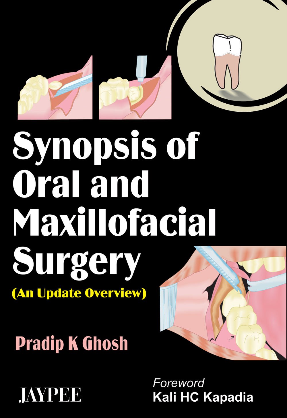 Synopsis Of Oral And Maxillofacial Surgery (An Update Overview)