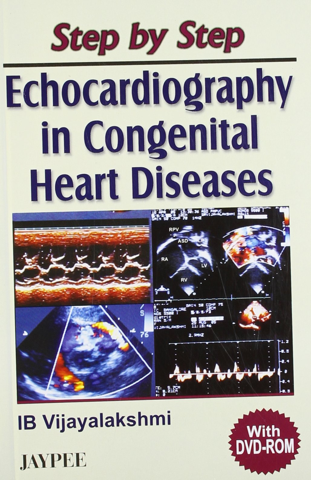 Step By Step Echocardiography In Congenital Heart Diseases With Dvd-Rom