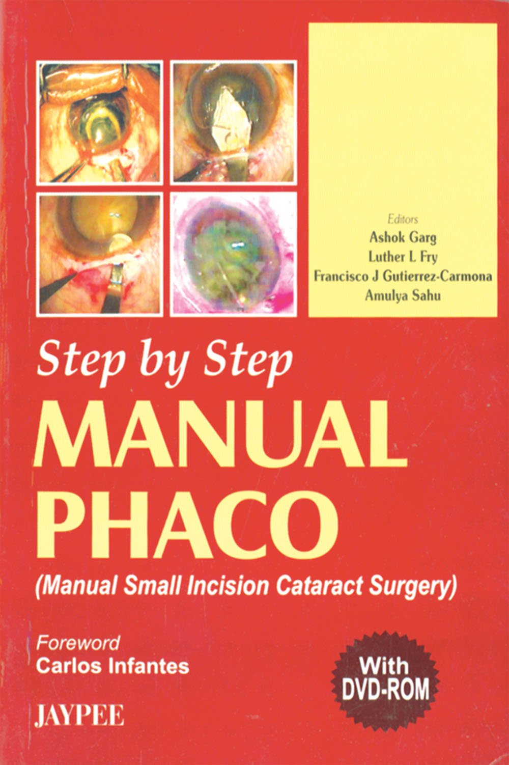 Step By Step Manual Phaco With Dvd-Rom