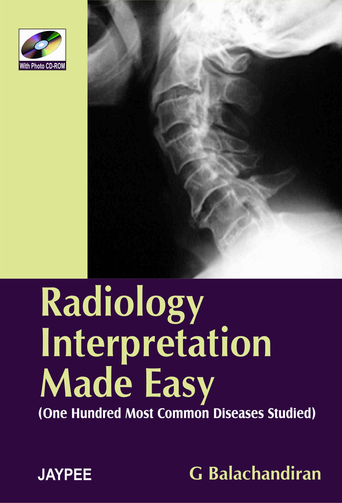 Radiology Interpretation Made Easy With Photo Cd-Rom