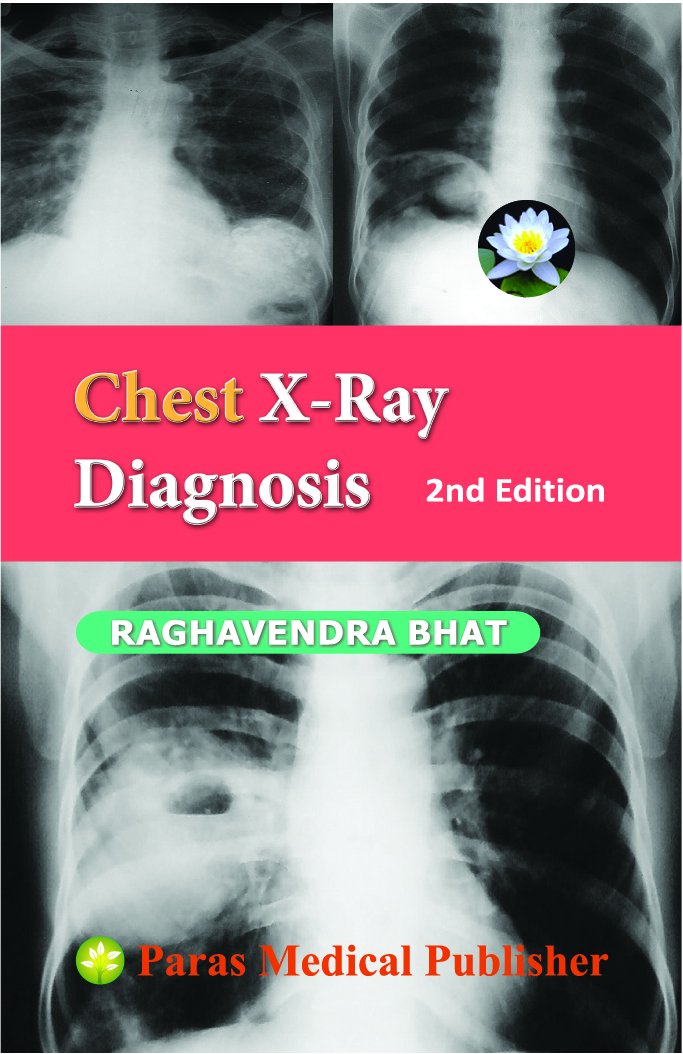 Chest X - Ray Diagnosis 2/Ed
