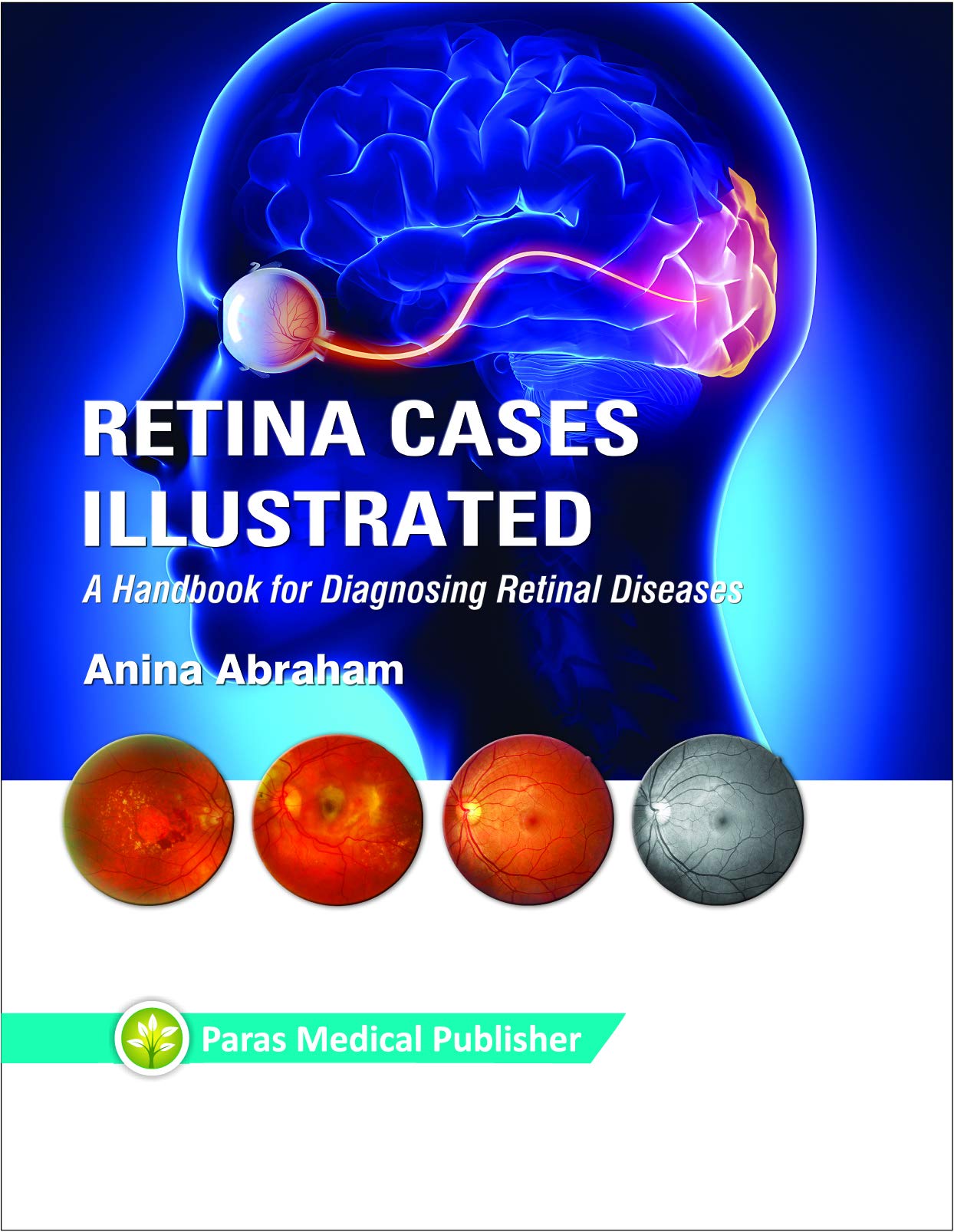 Retina Cases Illustrated