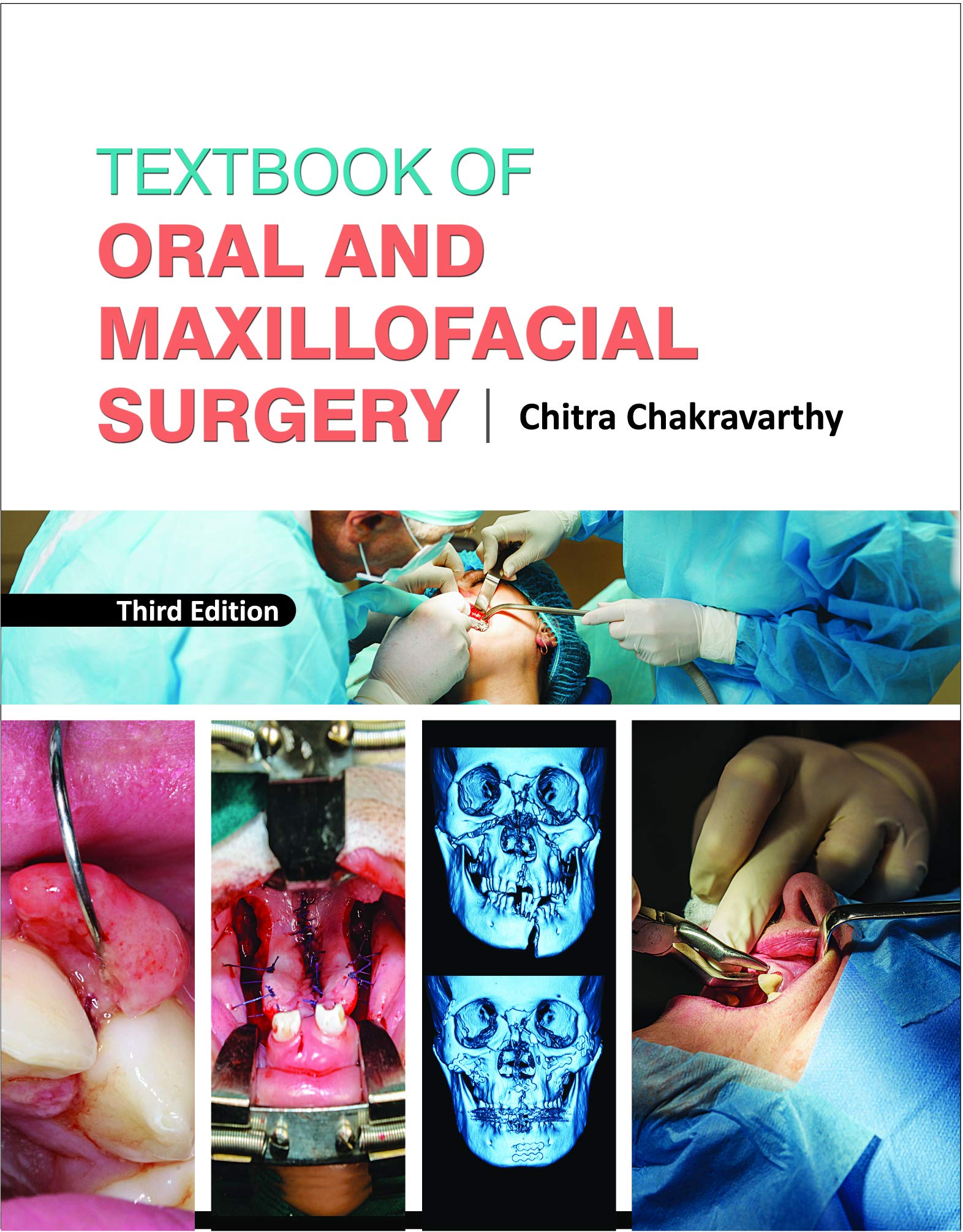 Textbook Of Oral And Maxillofacial Surgery Third Edition